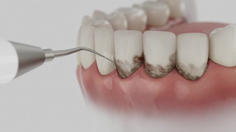 Reliable Dental Implants contractor in Mountain Lake, MN by Smile Center Dentistry